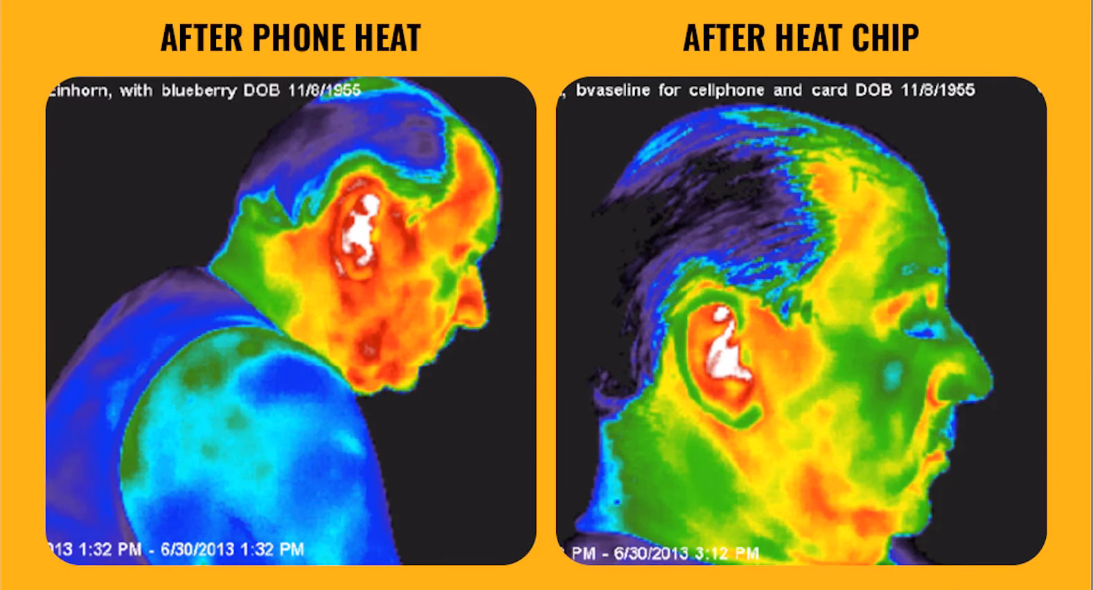 Does switching off phone data and WiFi reduce radiation?
