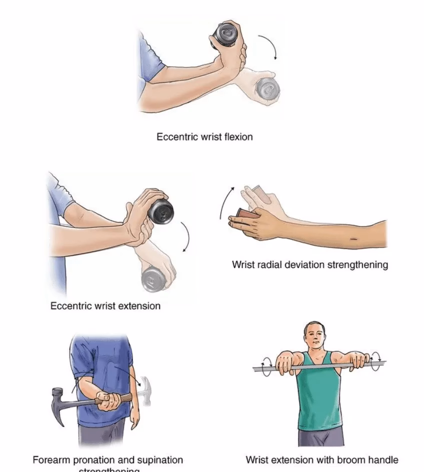 What are the best elbow range of motion exercises after a fracture?
