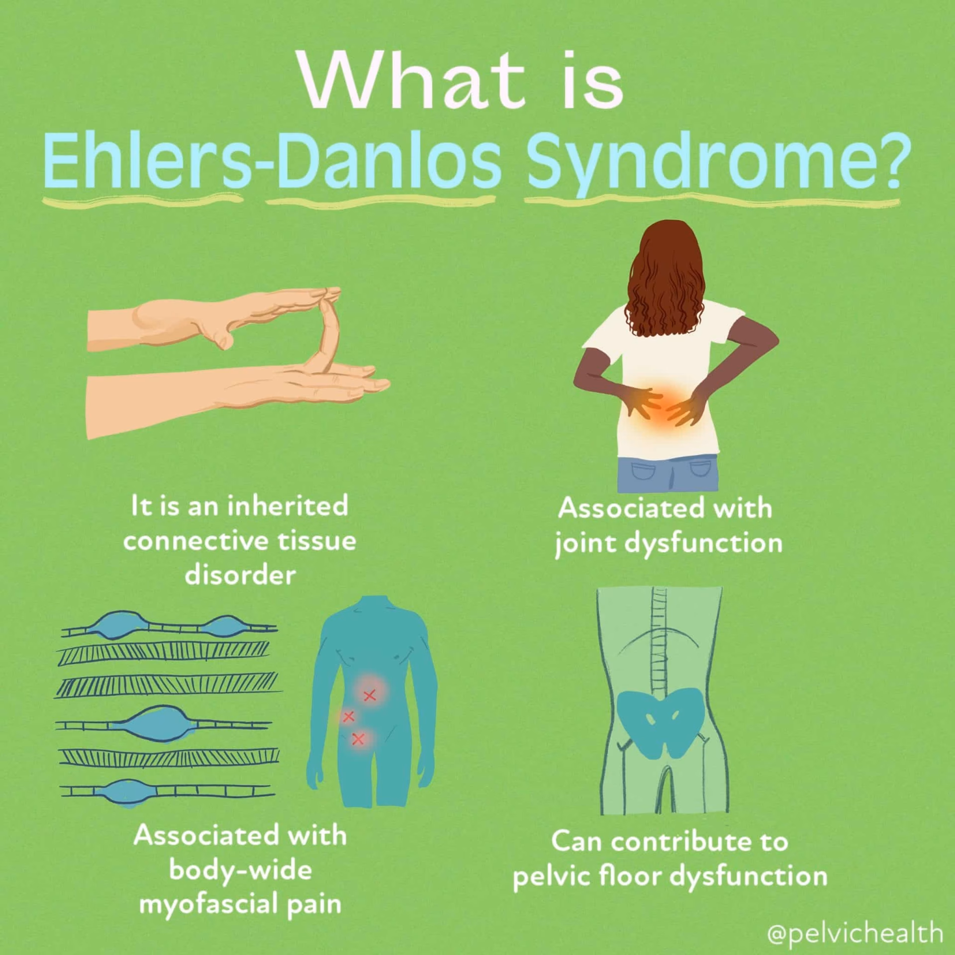 How do you know if you have hypermobile Ehlers-Danlos syndrome?