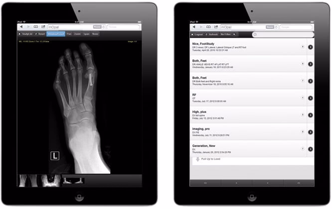 What is mobile DICOM (DICONDE) viewer?