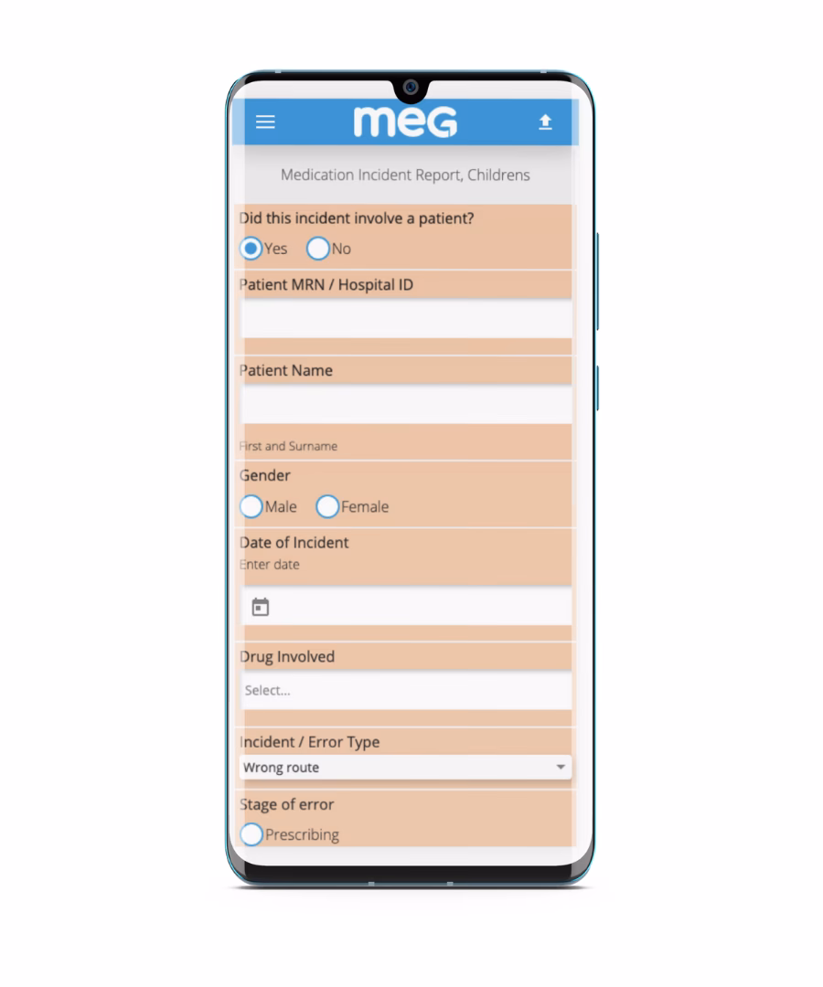 What is a wearable MEG system?