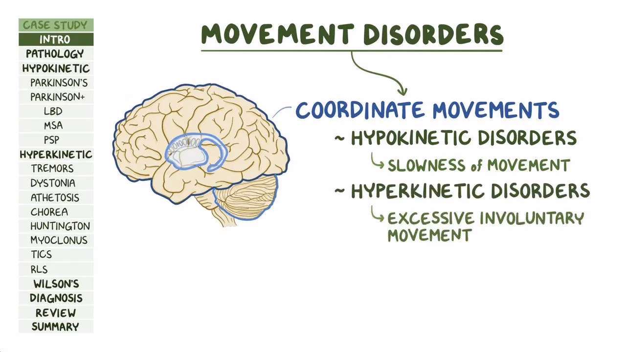 Are movement disorders treatable?