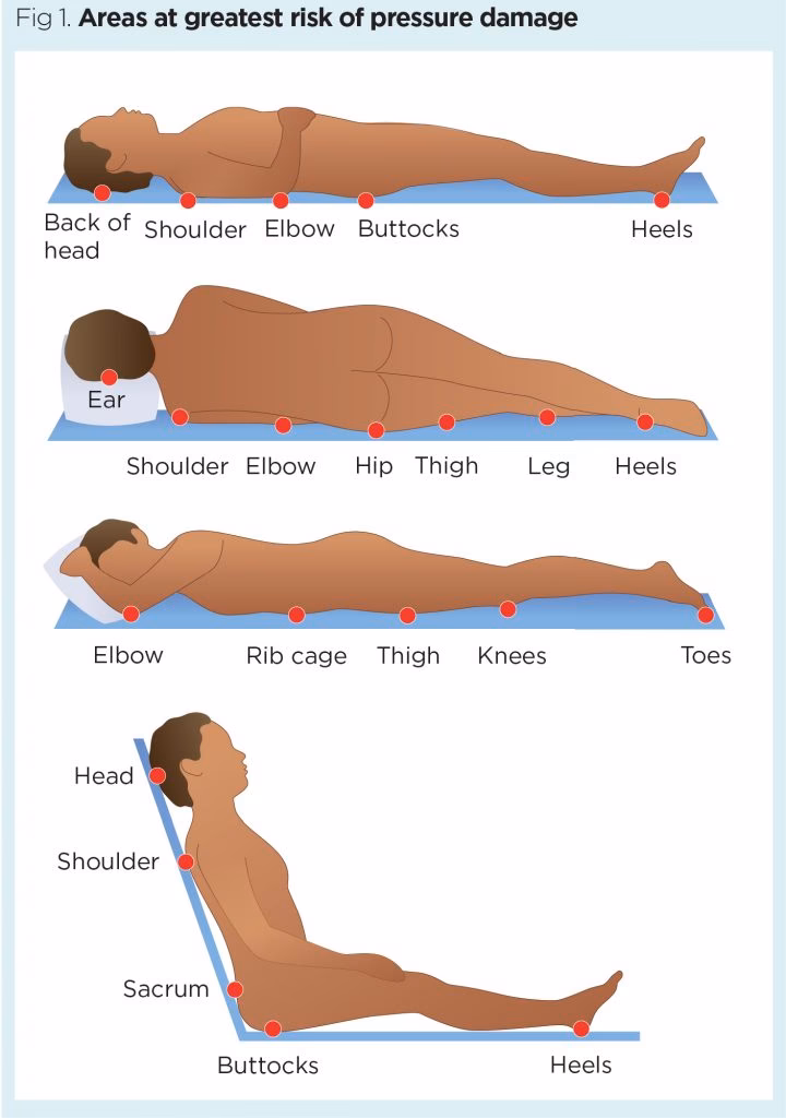 How do organisations manage pressure injuries?