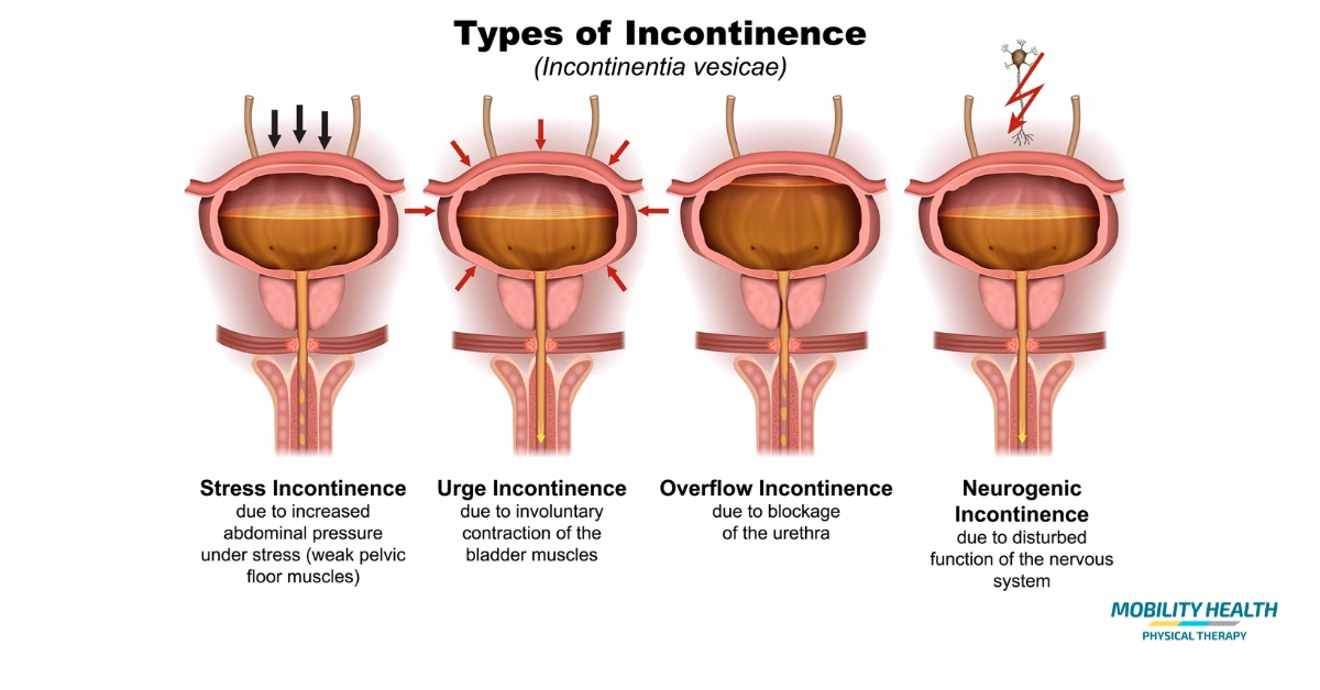 Is there an association between impaired mobility and urinary incontinence?